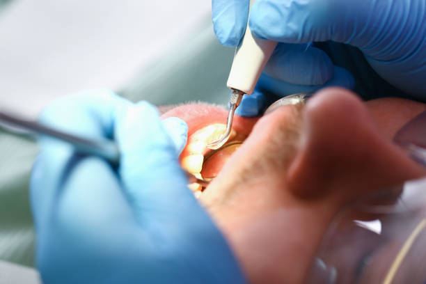 Emergency Dentist Open Today in MI
